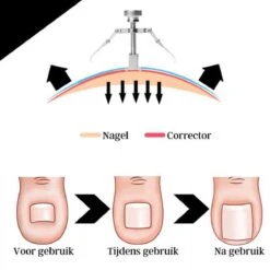 7-Delige Pedicure Set - Nagelverzorging - Nagelset - Ingegroeide Teennagel - Nagelknipper - Nail Clippers - Ingrown Toenail 27 7-Delige Pedicure Set - Nagelverzorging - Nagelset - Ingegroeide Teennagel - Nagelknipper - Nail Clippers - Ingrown Toenail -Gillette Winkel 1200x1200 1698