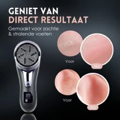 Beeperfect® Elektrische Eeltverwijderaar Met Stofzuigsysteem - Voetvijl - Eeltvijl - IPX7 Waterdicht - Gratis Pedicure Set - Zwart 16 Beeperfect® Elektrische Eeltverwijderaar Met Stofzuigsysteem - Voetvijl - Eeltvijl - IPX7 Waterdicht - Gratis Pedicure Set - Zwart -Gillette Winkel 1200x1200 1730