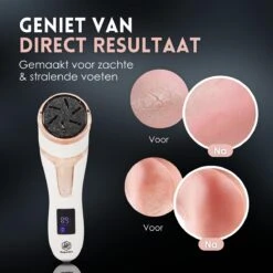 Beeperfect® Elektrische Eeltverwijderaar Met Stofzuigsysteem - Voetvijl - Eeltvijl - IPX7 Waterdicht - Gratis Pedicure Set 16 Beeperfect® Elektrische Eeltverwijderaar Met Stofzuigsysteem - Voetvijl - Eeltvijl - IPX7 Waterdicht - Gratis Pedicure Set -Gillette Winkel 1200x1200 1776