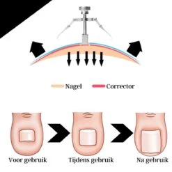 7-delige Pedicure En Manicure Set - Nagelknipper - Pedicureset - Nagelvijl - Nageltang - Kalknagel - Teennagelknipper 16 7-delige Pedicure En Manicure Set - Nagelknipper - Pedicureset - Nagelvijl - Nageltang - Kalknagel - Teennagelknipper -Gillette Winkel 1200x1200 1799