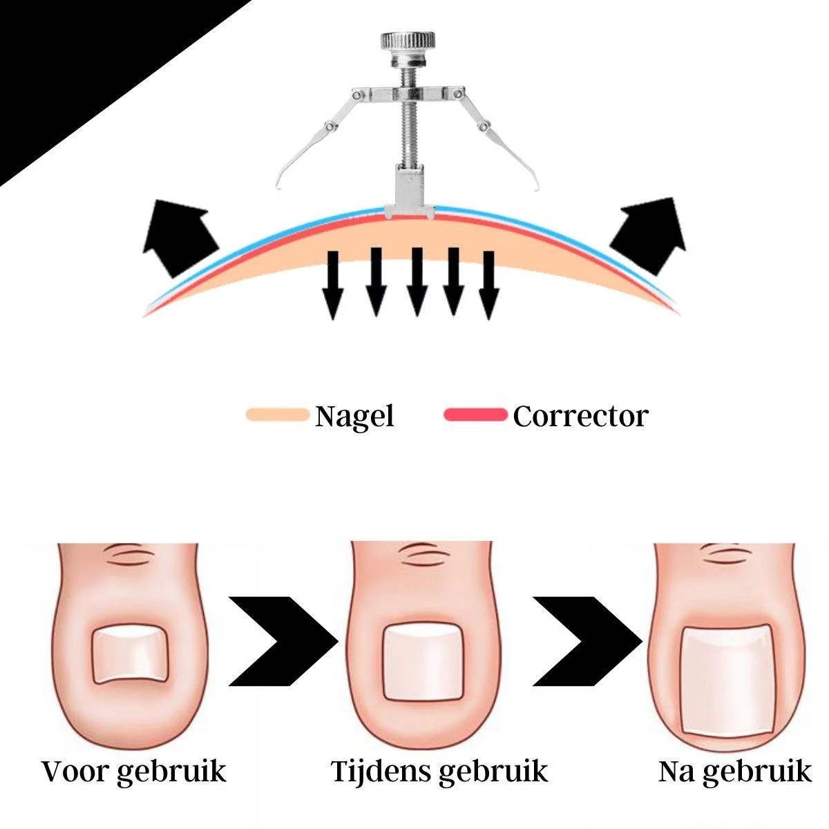 7-delige Pedicure En Manicure Set - Nagelknipper - Pedicureset - Nagelvijl - Nageltang - Kalknagel - Teennagelknipper 7 7-delige Pedicure En Manicure Set - Nagelknipper - Pedicureset - Nagelvijl - Nageltang - Kalknagel - Teennagelknipper - Afbeelding 5