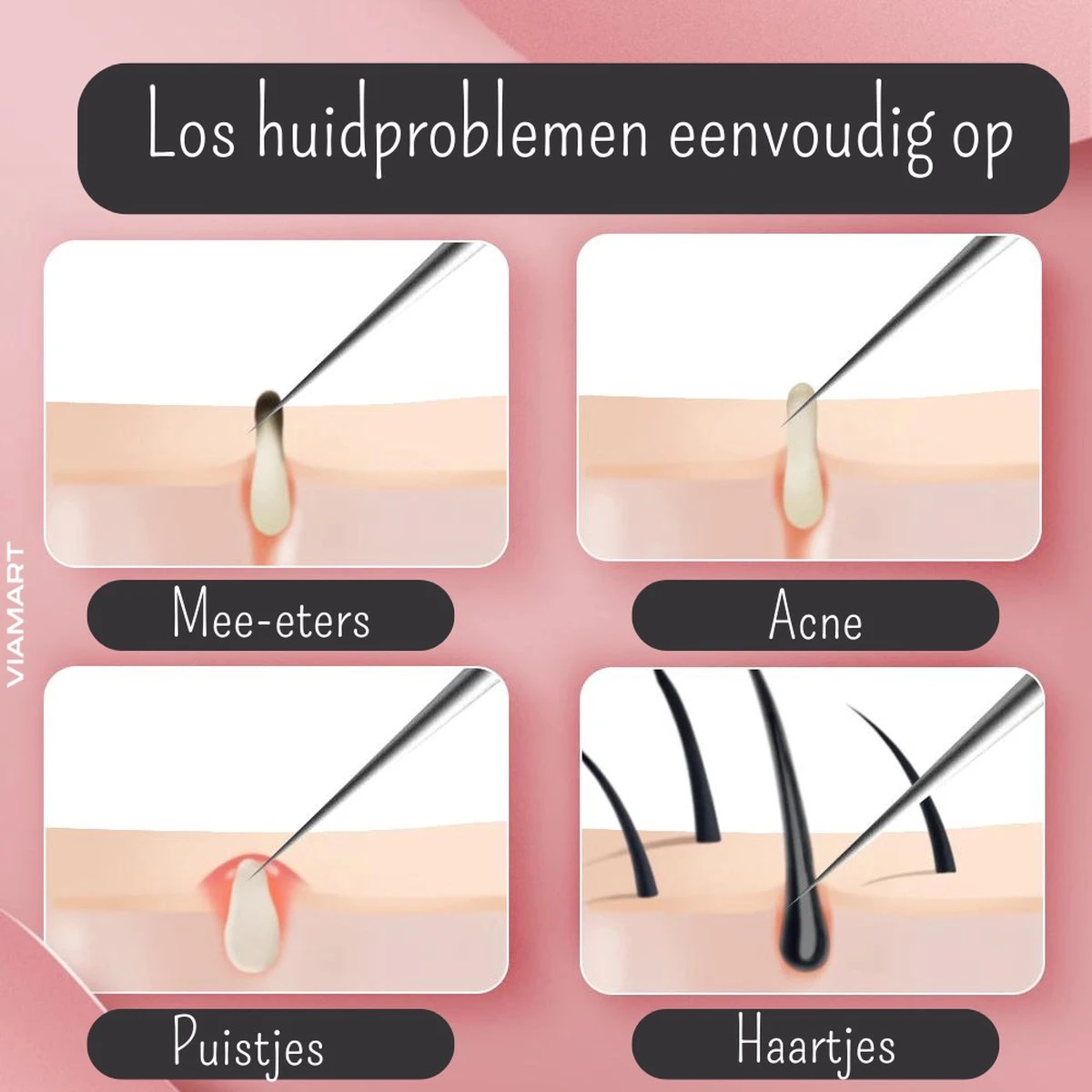 Viamart - Ultrafijn Pincet - Los Eenvoudig Huidproblemen Op: Acne, Mee-eters, Haartjes, Puistjes, Splinters En Teken 4 Viamart - Ultrafijn Pincet - Los Eenvoudig Huidproblemen Op: Acne, Mee-eters, Haartjes, Puistjes, Splinters En Teken - Afbeelding 2