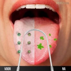 SolidStock Professionele Tongschraper Voor Mondverzorging - 4 Delige Tongreiniger - Ayurveda - RVS 14 SolidStock Professionele Tongschraper Voor Mondverzorging - 4 Delige Tongreiniger - Ayurveda - RVS -Gillette Winkel 1200x1200 226