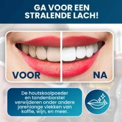 Tandenbleekset - Teeth Whitening - Teeth Whitener - Wittere Tanden - Tanden Bleken - Direct Resultaat - Zelfde Effect Als Whitening Strips -Gillette Winkel 1200x1200 23