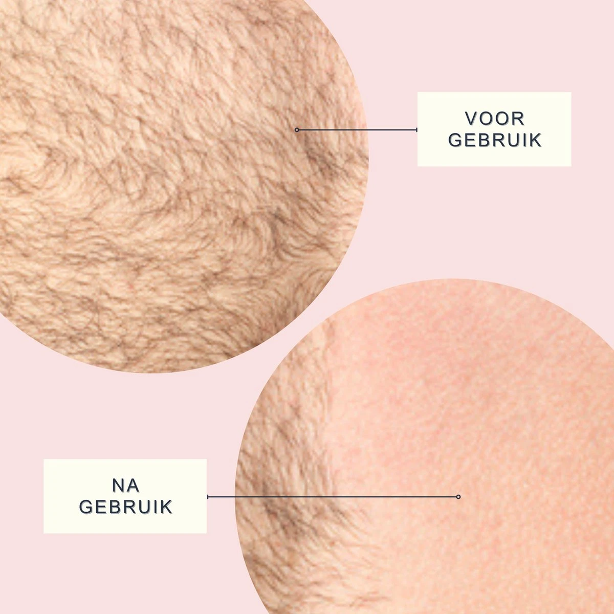 Merkloos Crystal Hair Removal Zwart - Crystal Hair Eraser - Epilator - Kristalpad - Ontharing - Pijnloos - Haarverwijderaar 9 Merkloos Crystal Hair Removal Zwart - Crystal Hair Eraser - Epilator - Kristalpad - Ontharing - Pijnloos - Haarverwijderaar - Afbeelding 7