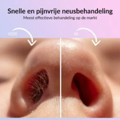 Rivema Luxe Wax Ontharing Set – Neus Ontharing – Wax Beans – Ontharingswax – Ontharen – 7 Maanden Haarvrij 13 Rivema Luxe Wax Ontharing Set – Neus Ontharing – Wax Beans – Ontharingswax – Ontharen – 7 Maanden Haarvrij -Gillette Winkel 1200x1200 2773