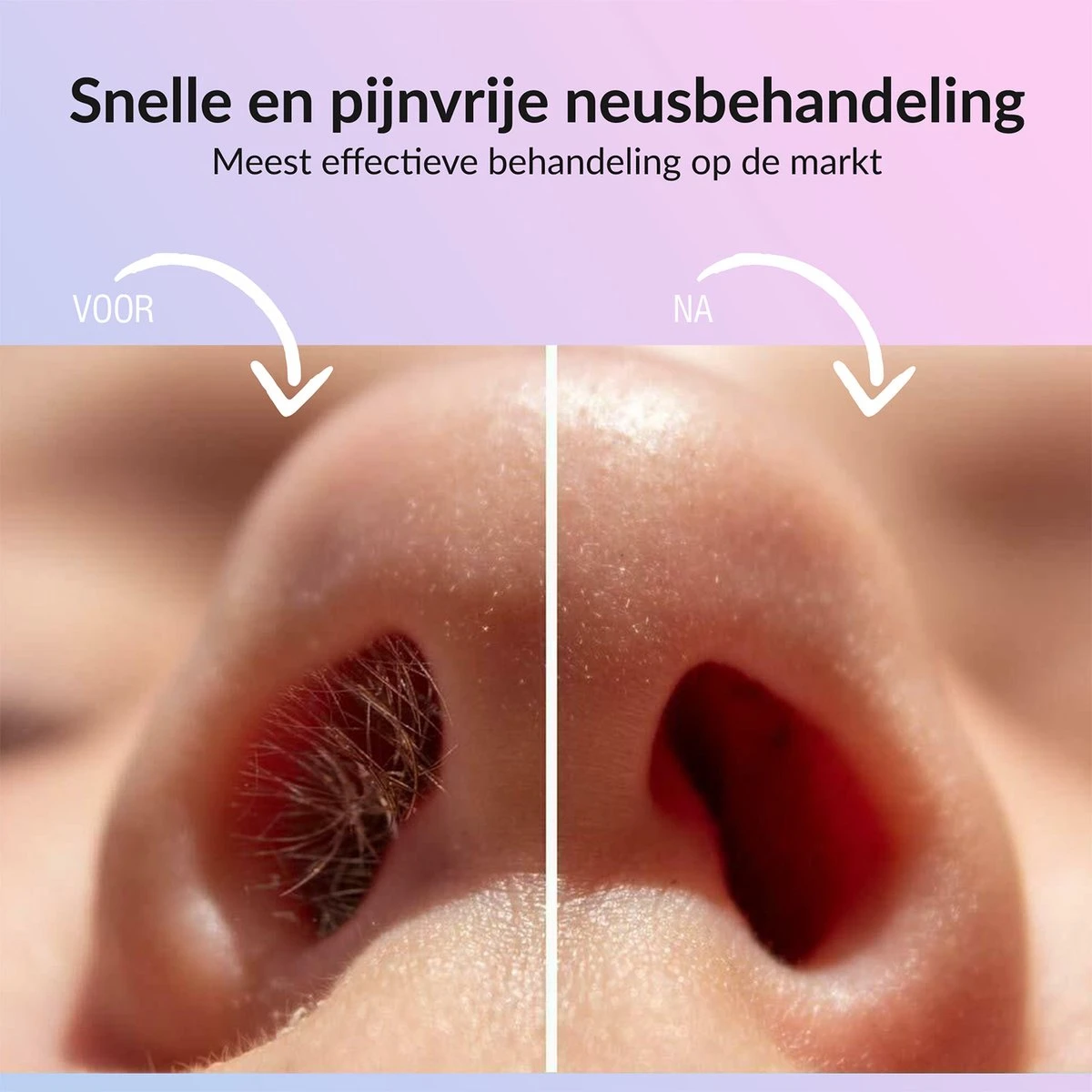 Rivema Luxe Wax Ontharing Set – Neus Ontharing – Wax Beans – Ontharingswax – Ontharen – 7 Maanden Haarvrij 7 Rivema Luxe Wax Ontharing Set – Neus Ontharing – Wax Beans – Ontharingswax – Ontharen – 7 Maanden Haarvrij - Afbeelding 5