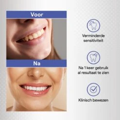 Merkloos Tanden Bleken Met 14 Sets Whitening Strips - Tandenbleekset Met Bamboe Tandenborstel - Tanden Bleekstrips 9 Merkloos Tanden Bleken Met 14 Sets Whitening Strips - Tandenbleekset Met Bamboe Tandenborstel - Tanden Bleekstrips -Gillette Winkel 1200x1200 3