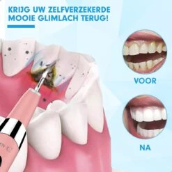 DEN-T® PRO U500 - Elektrische Sonische Tandsteen Verwijderaar - Roze -Gillette Winkel 1200x1200 343