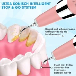 DEN-T® PRO U500 - Elektrische Sonische Tandsteen Verwijderaar - Roze -Gillette Winkel 1200x1200 345