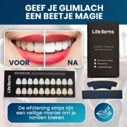 Tandenbleekset Voor Teeth Whitening Inclusief Gratis Whitening Strips - Wittere Tanden - Tanden Bleken - Frisse Adem - Tandsteen - Tandplak - Gele Tanden -Gillette Winkel 1200x1200 46
