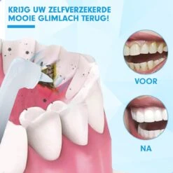 DEN-T® PRO P350 Elektrische Tandenpolijster - Wit - 5 Standen - 5 Opzetstukken - Polijstmachine - Polijstset - Tanden Polijsten - -Gillette Winkel 1200x1200 658