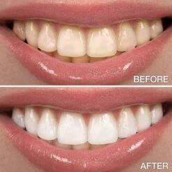 Perfect Wit - Whitening Pen - Tandenblekers - 100% Natuurlijke Ingrediënten - Peroxidevrij - Veilig Bleken - Witte Tanden - Tandbleekset - Tanden Bleken - Whitening - Teeth Whitening - Frisse Adem -Gillette Winkel 1200x1200 71