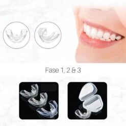 Edoir Rechte Tanden Beugel - Retainer Voor Rechte Tanden - Rechte Tanden Bitje 12 Edoir Rechte Tanden Beugel - Retainer Voor Rechte Tanden - Rechte Tanden Bitje -Gillette Winkel 1200x1200 82