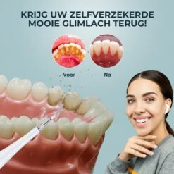 Merkloos Tandsteen Verwijderaar Elektrisch – Tandenborstel Opzetstukken - Tandarts Spiegel - 5 Standen -Wit -Gillette Winkel 1200x1200 856