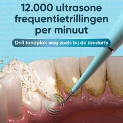 Whitee Elektrische Tandsteen Verwijderaar - Tanden Polijsten - Tandarts Tandsteenverwijderaars - Elektrisch Tandplak Verwijderen -Gillette Winkel 1200x1200 868