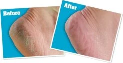 O'Keeffe's - Voetencreme - Voor Gezonde Voeten - Potje 96 Gram -Gillette Winkel 1200x622