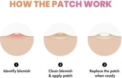 Merkloos Pimple Patch - Acne Patch - Puisten Patch - Acne Sticker - Puisten Pleister - Pimple Patches - Acne Pleister - Puisten Verwijderaar - Puisten Creme - Acne Verwijderen Set - Acneverzorging | 36 Stuks & Directe Levering -Gillette Winkel 1200x769 1