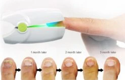 Anti Schimmelnagel Kalknagel Laserapparaat Om Zelf Te Behandelen, Veilig, Effectief, Snel En Pijnloos, Koude Laser Behandeling Voor Thuisgebruik, Voor Tenen En Vingers. Oplaadbaar. 12 Anti Schimmelnagel Kalknagel Laserapparaat Om Zelf Te Behandelen, Veilig, Effectief, Snel En Pijnloos, Koude Laser Behandeling Voor Thuisgebruik, Voor Tenen En Vingers. Oplaadbaar. -Gillette Winkel 1200x774 3