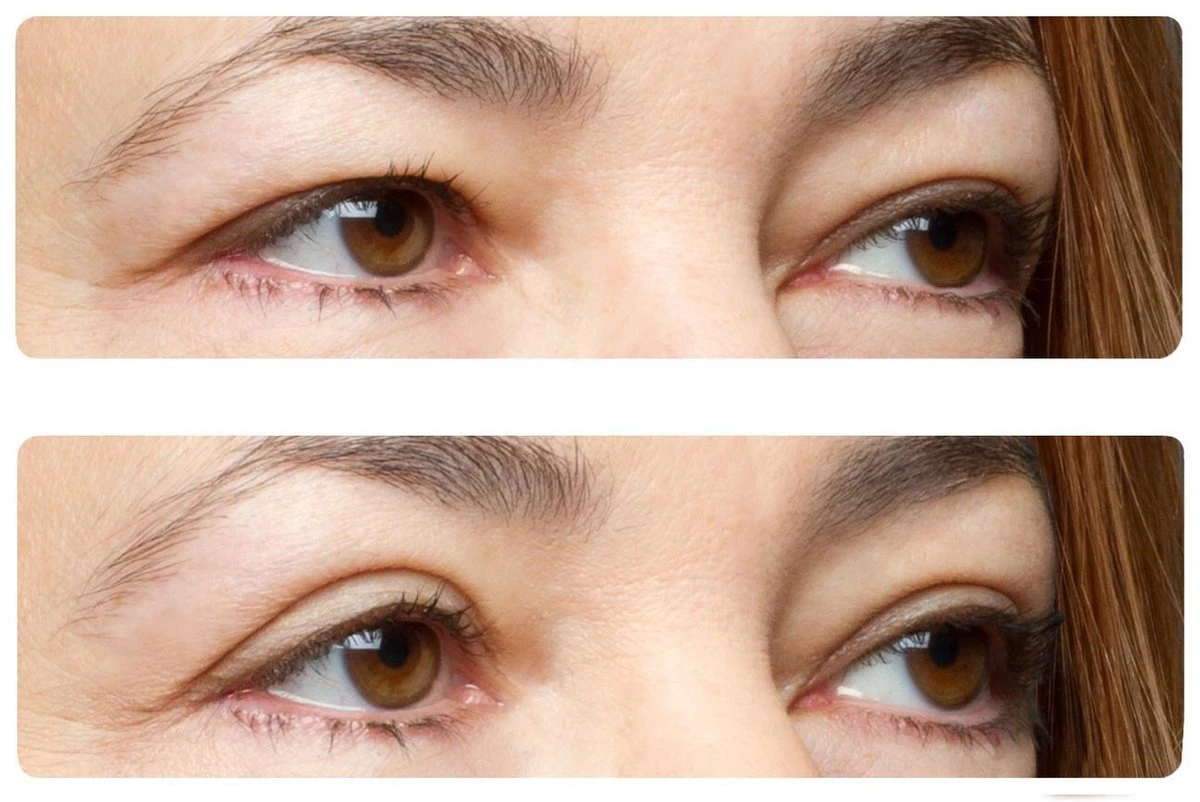 Easy Lift Ooglitstickers Ooglidtape Ooglidstickers - Lift Je Oogleden Zonder Operatie - Tegen Hangende Ogen 5 Easy Lift Ooglitstickers Ooglidtape Ooglidstickers - Lift Je Oogleden Zonder Operatie - Tegen Hangende Ogen - Afbeelding 3