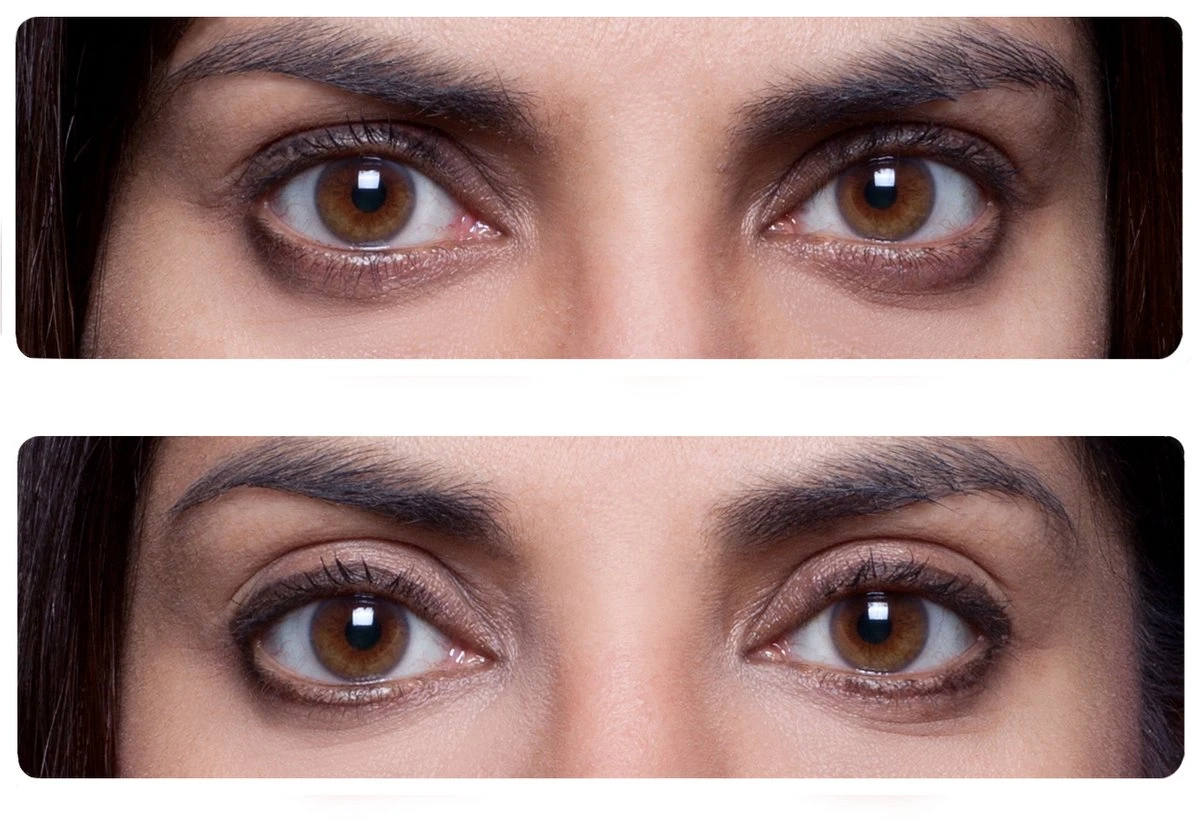 Easy Lift Ooglitstickers Ooglidtape Ooglidstickers - Lift Je Oogleden Zonder Operatie - Tegen Hangende Ogen 4 Easy Lift Ooglitstickers Ooglidtape Ooglidstickers - Lift Je Oogleden Zonder Operatie - Tegen Hangende Ogen - Afbeelding 2