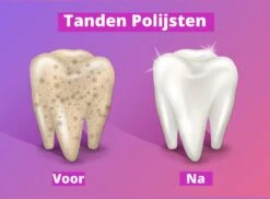 Merkloos HQ Tooth Polisher - Tanden Polijsten - Wittere Tanden - Tandsteen Tandplak Verwijderaar - Elektrisch -Gillette Winkel 1200x886