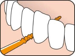 Tepe EasyPick Oranje Maat XS/S – 36 Stuks -Gillette Winkel 1200x897