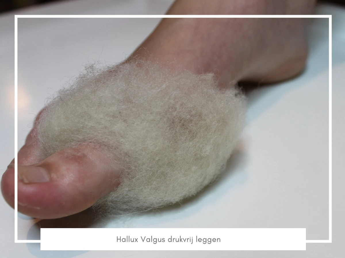 Merkloos WandelWol 10 Gram - De Oplossing Bij Blaren En Voet Ongemak - Antidruk & Antiblaar 4 Merkloos WandelWol 10 Gram - De Oplossing Bij Blaren En Voet Ongemak - Antidruk & Antiblaar - Afbeelding 2