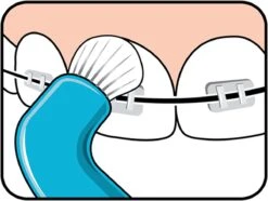 TePe Compact Tuft - Single Tufted Borstel - Tandenborstel -Gillette Winkel 1200x902 3