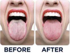 JuliBrite Tong Gel (50 ML) Tongreinigende Gel - Verfrist De Adem - Schone Tong -Gillette Winkel 1200x914 1