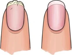 Herome 3 In 1 Manicure Nagelverzorging Set Blauw – Nagelset Voor Beschadigde Nagels - Nagelverharder, Nagellakremover En Nagelriemcreme - Set Van 3 -Gillette Winkel 1200x920 3