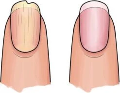 Herome 3 In 1 Manicure Nagelverzorging Set (Nail Essentials Geel) – Nagelset Voor Droge En Geribbelde Nagels – Base Coat, Vijl En Voedende Nagelolie – Voor Egale En Flexibele Nagels -Gillette Winkel 1200x926 3