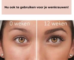 Beautyfit®2 In 1 Wimperserum En Wenkbrauw Serum - BEST WERKEND - Eye Lash Serum - Wimper Serum - Wenkbrauw Groei Serum - Lash Lift Kit - Wimper Lift - Snel Resultaat Wimpergroei -Gillette Winkel 1200x972 2