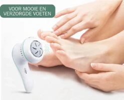 Merkloos Elektrische Eelt Verwijderaar - Voetvijl - Krachtige Motor 2500rpm - Geïntegreerde Zuigfunctie - Usb Oplaadbaar - 3 Vijlschijven - Nieuw Model 2021 -Gillette Winkel 1200x977 6