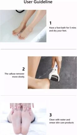 Vastu Eeltverwijderaar - Elektrische Oplaadbare Voetvijl Inclusief Opvangdoekje & Opbergzakje - Callus Remover - Inclusief Extra Opzetvijlen -Gillette Winkel 686x1200 3