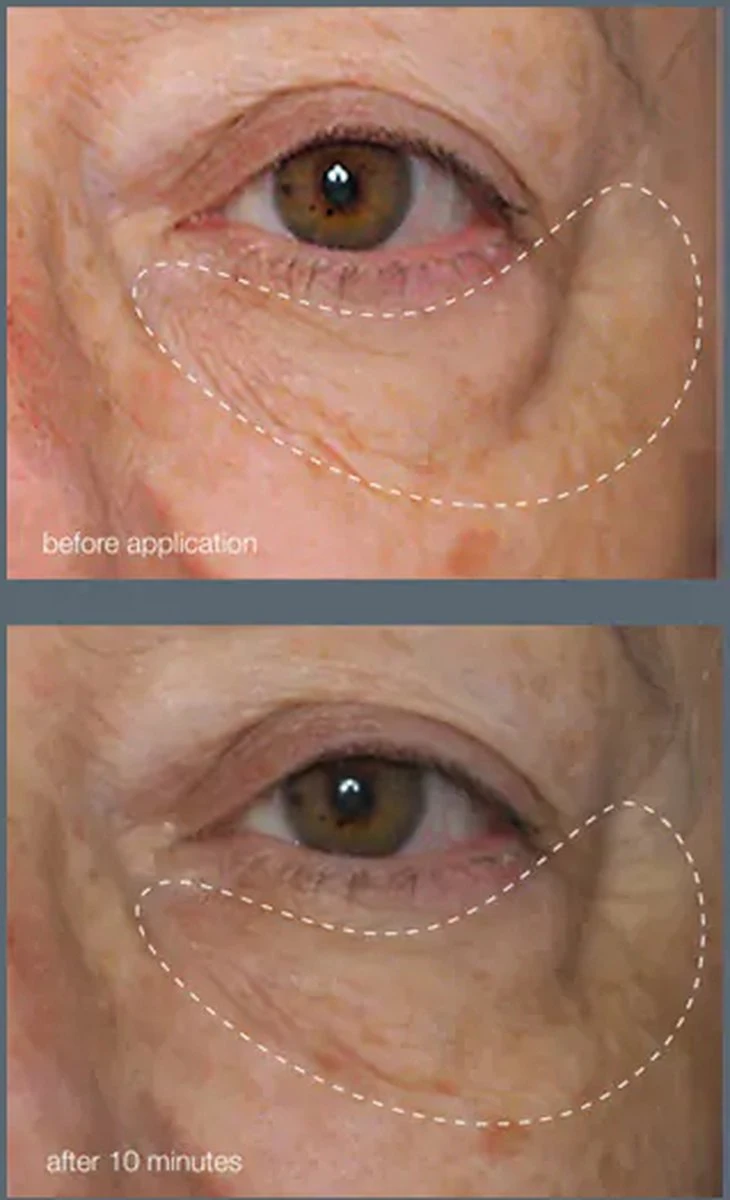 Dermalogica - Awaken Peptide Eye Gel - Revitaliserend - Hydraterend 5 Dermalogica - Awaken Peptide Eye Gel - Revitaliserend - Hydraterend - Afbeelding 3