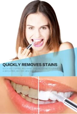 Perfect Wit - Whitening Pen - Tandenblekers - 100% Natuurlijke Ingrediënten - Peroxidevrij - Veilig Bleken - Witte Tanden - Tandbleekset - Tanden Bleken - Whitening - Teeth Whitening - Frisse Adem -Gillette Winkel 810x1200