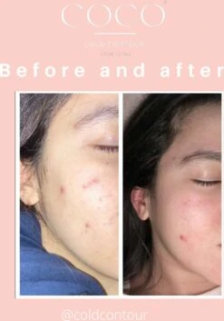 COLDCONTOUR - Skin Ice Roller Gezicht- Facial Icing- Roze - Aftersun- Cadeautip - Anti Rimpel- Ice Globes - Ijs Gezicht - Gezichtsmassage Roller - Huidverjongingsapparaat - Anti Aging- Cadeau 37 COLDCONTOUR - Skin Ice Roller Gezicht- Facial Icing- Roze - Aftersun- Cadeautip - Anti Rimpel- Ice Globes - Ijs Gezicht - Gezichtsmassage Roller - Huidverjongingsapparaat - Anti Aging- Cadeau -Gillette Winkel 839x1200 1