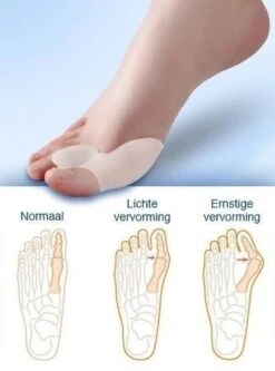 MYCARE+ Teencorrector - Wasbare Teencorrector - Gel-laag - 1 Paar - Pijn Verlichtend 11 MYCARE+ Teencorrector - Wasbare Teencorrector - Gel-laag - 1 Paar - Pijn Verlichtend -Gillette Winkel 890x1200 9