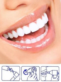 Merkloos HQ Tooth Polisher - Tanden Polijsten - Wittere Tanden - Tandsteen Tandplak Verwijderaar - Elektrisch -Gillette Winkel 900x1200 1