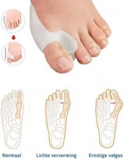 MYCARE+ Teencorrector - Wasbare Teencorrector - Gel-laag - 1 Paar - Pijn Verlichtend 12 MYCARE+ Teencorrector - Wasbare Teencorrector - Gel-laag - 1 Paar - Pijn Verlichtend -Gillette Winkel 936x1200 4