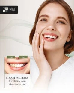 Tandenbleekset INCL. 14 Whitening Strips En 6 Gelpennen - ZONDER PEROXIDE - Teeth Whitening Kit - Tandenbleekset Met Ebook En Nederlandse Handleiding - Tandenblekers - Valentijnsdag Cadeau 18 Tandenbleekset INCL. 14 Whitening Strips En 6 Gelpennen - ZONDER PEROXIDE - Teeth Whitening Kit - Tandenbleekset Met Ebook En Nederlandse Handleiding - Tandenblekers - Valentijnsdag Cadeau -Gillette Winkel 960x1200 3