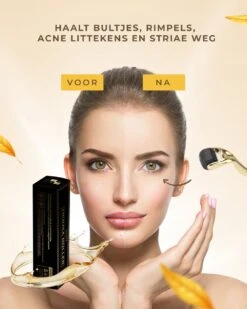 Dermaroller – 540 Micro Naalden – 0.5 MM Needle – Huidverjonging – Huidverzorging – Littekens – Striea – Steriel Verpakt -Gillette Winkel 960x1200 39