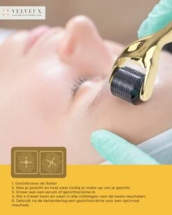 Dermaroller – 540 Micro Naalden – 0.5 MM Needle – Huidverjonging – Huidverzorging – Littekens – Striea – Steriel Verpakt -Gillette Winkel 960x1200 40